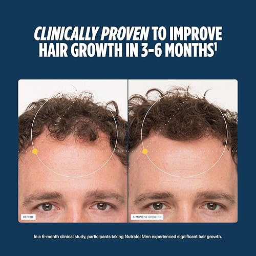 Before and after comparison of hair growth with text claiming clinical improvement in 3-6 months. Nutrafol Men (3 Month Supply)