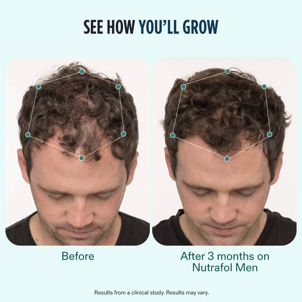 Nutrafol Men (3-Month Supply) + Collagen Renewal Bundle
