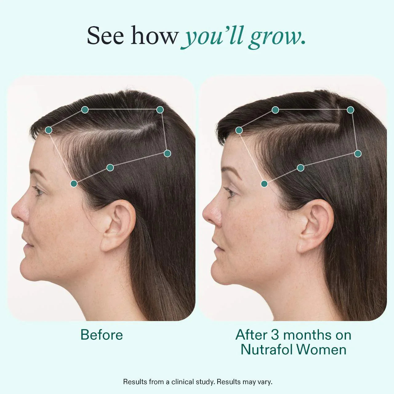 Nutrafol Women (3 Month Supply)