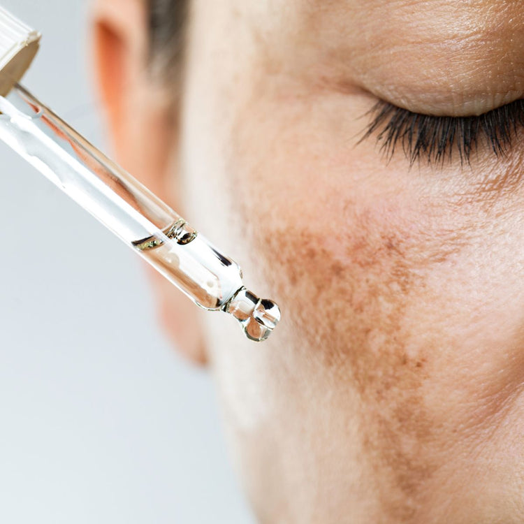 Hyperpigmentation & Dark Spots