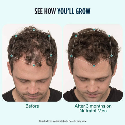 Nutrafol Men (3-Month Supply) + Collagen Renewal Bundle