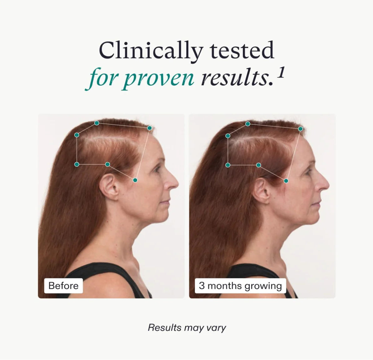 Before and after comparison of hair growth on a person's head with text indicating clinical testing.