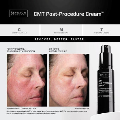 Revision Skincare CMT Post-Procedure Cream (0.5 oz)