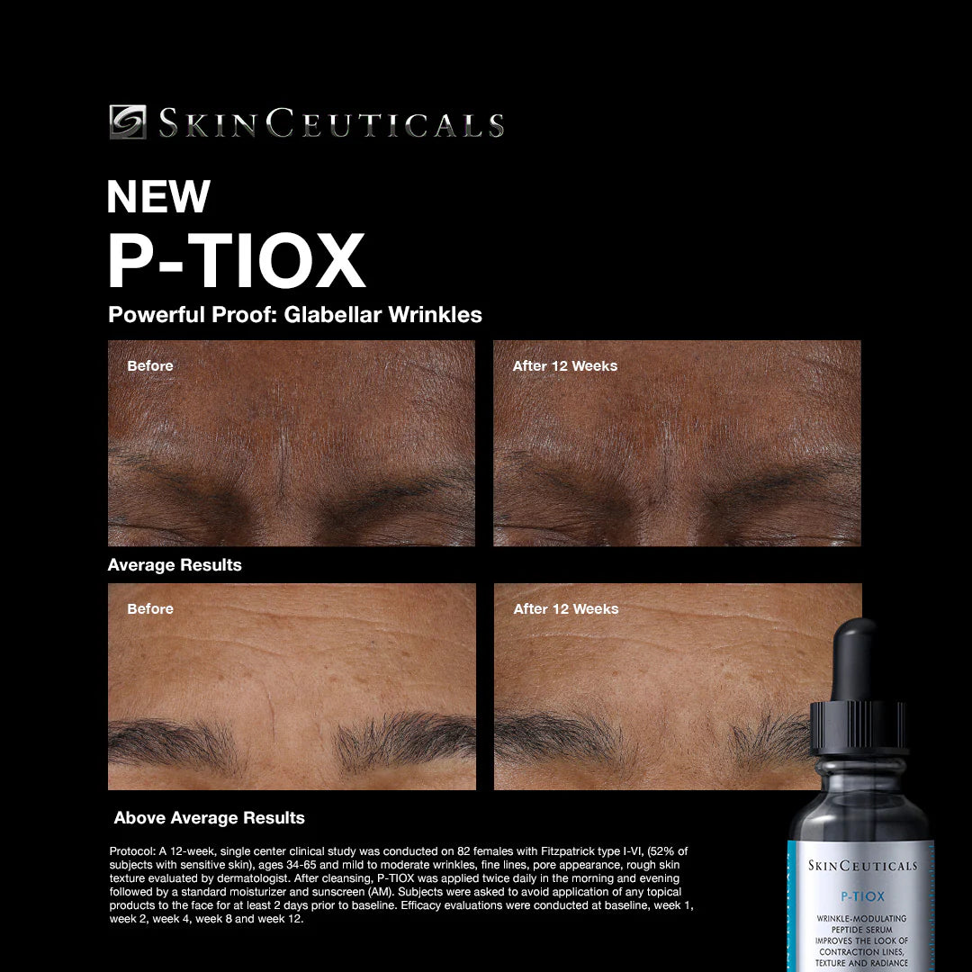 SkinCeuticals P-Tiox (30 ml)