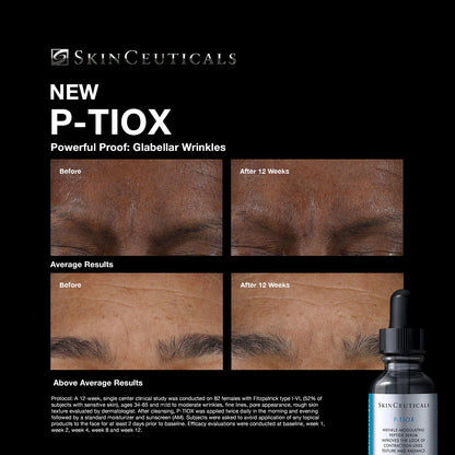 SkinCeuticals P-Tiox (30 ml)