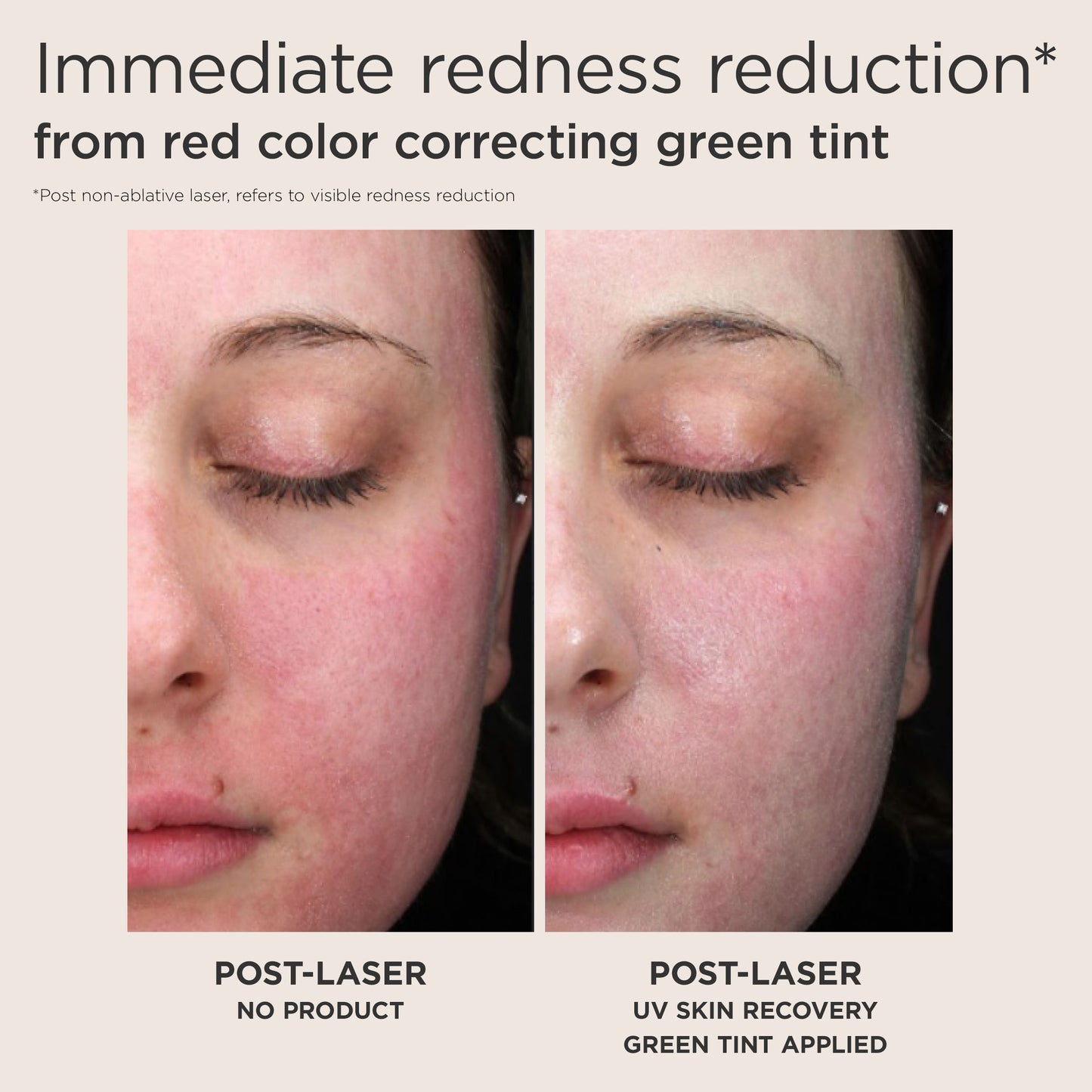 EltaMD UV Skin Recovery Broad-Spectrum SPF 50 GREEN-TINTED (1.07 oz)