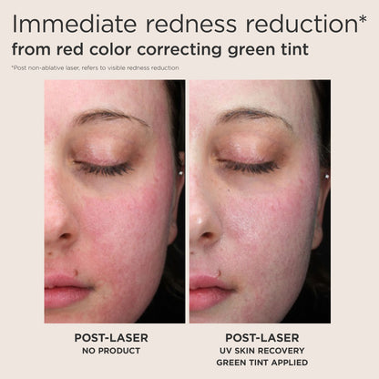 EltaMD UV Skin Recovery Broad-Spectrum SPF 50 GREEN-TINTED (1.07 oz)