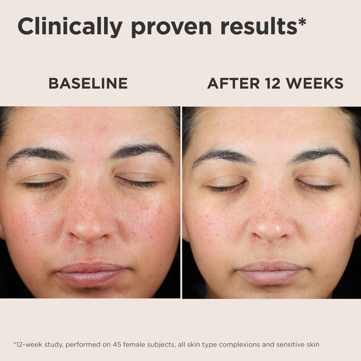 EltaMD UV Skin Recovery Broad-Spectrum SPF 50 NON-TINTED (1.07 oz)