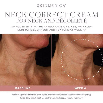 Restore smoother-looking neck skin with SkinMedica Neck Correct Cream, a hydrating formula designed for daily anti-aging skincare